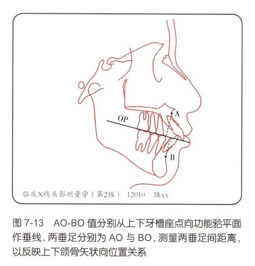 Tweed正畸理论的核心原理与应用价值何在?-图2 Tweed正畸理论的核心原理与应用价值何在?-图2