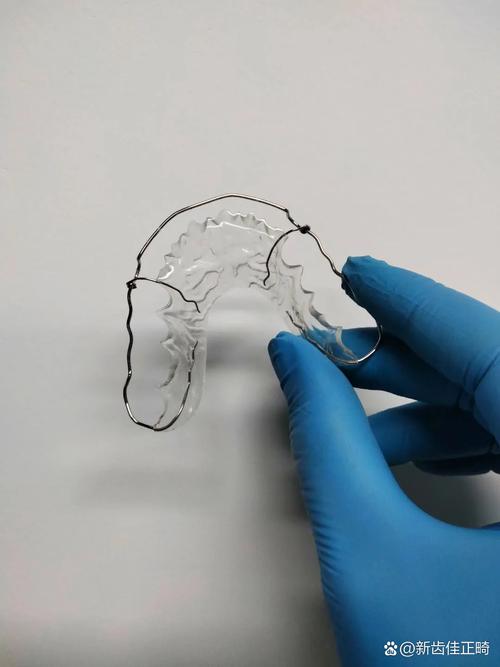 牙外伤固定方法如何选择?具体适用情况有哪些?-图3 牙外伤固定方法如何选择?具体适用情况有哪些?-图3