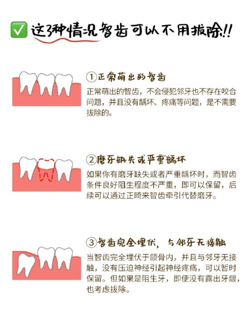 智齿治疗有哪些方法？如何选择最佳方案？-图2