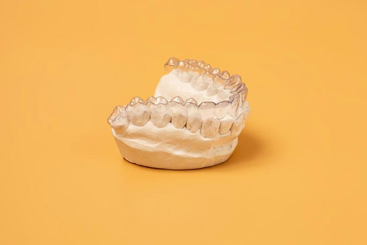 edgewise正畸，矫正牙齿的独特优势是什么？-图2