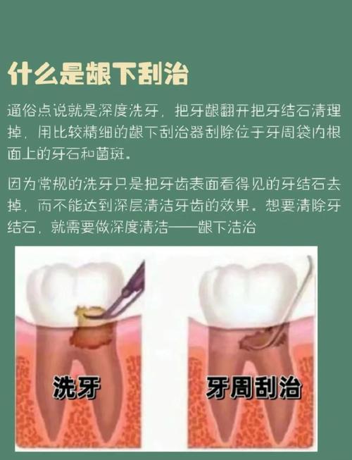 牙龈下洁牙的正确操作方法有哪些步骤？-图2