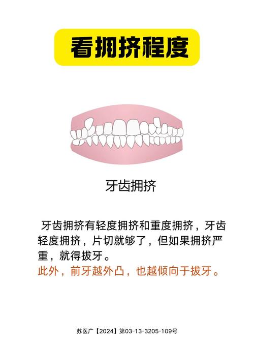 拔牙正畸vs不拔牙正畸，如何抉择更合适？-图1