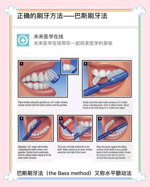 正畸矫正期间，患者是否必须使用正畸专用牙刷？-图1