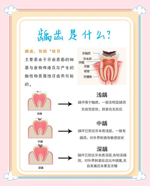 龋齿去除方法有哪些？不同龋坏程度怎么选？-图2
