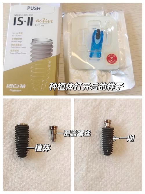 种植钉植入方法的具体操作步骤是什么？-图2