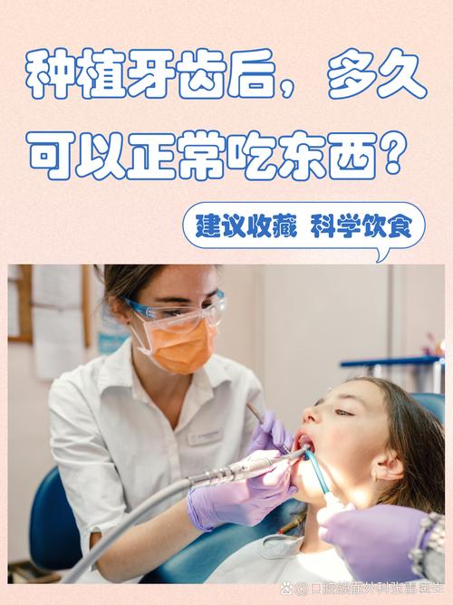 种牙后一般需要多长时间才能正常吃东西?-图1 种牙后一般需要多长时间才能正常吃东西?-图1