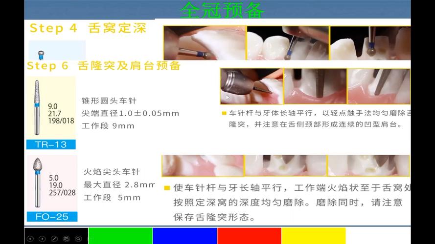 后牙备肩台方法如何规范操作？关键步骤有哪些？-图1