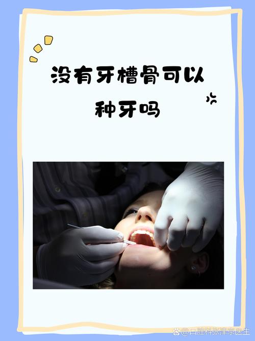 没有牙根能种牙吗？种植体如何实现稳固？-图2