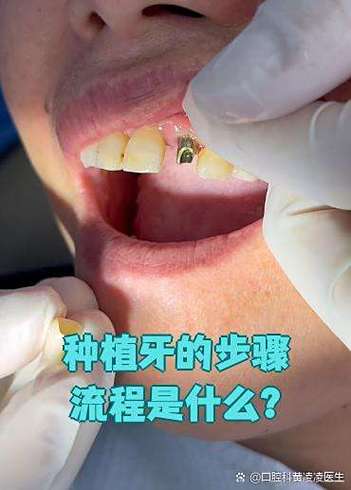 种牙需要检查什么-图2