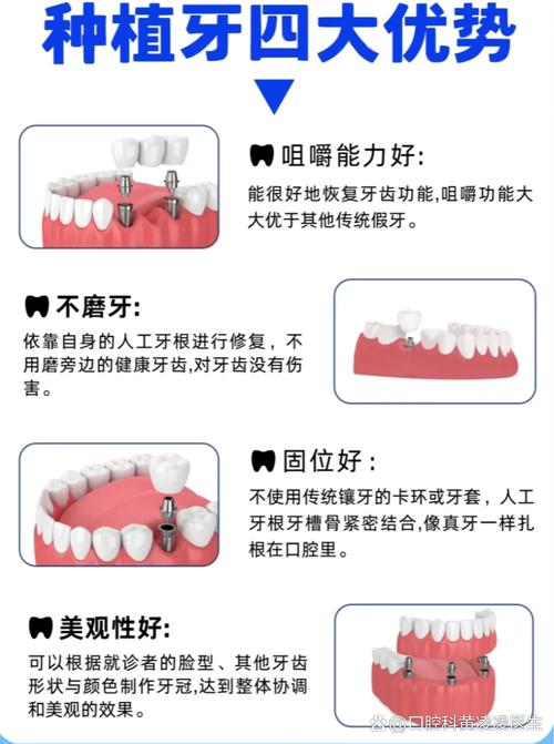 种牙和植牙是一回事吗？两者到底有啥区别？-图2