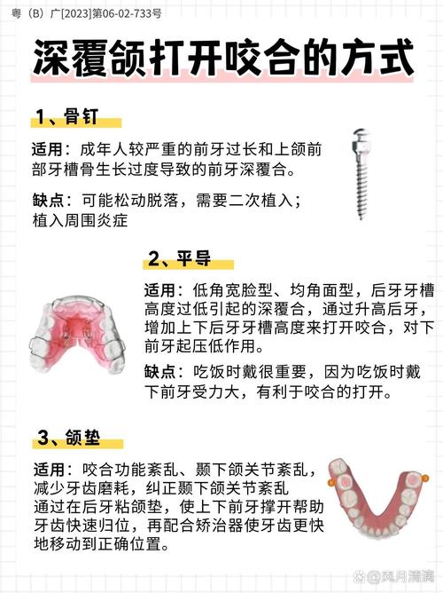 如何制作牙合垫?具体步骤与注意事项有哪些?-图2 如何制作牙合垫?具体步骤与注意事项有哪些?-图2