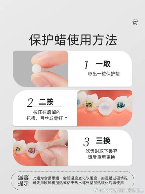 矫正蜡的正确使用方法有哪些步骤？-图1