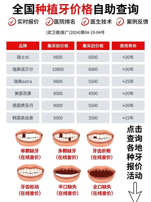 2025免费种牙是否真实？申请条件有哪些？-图1