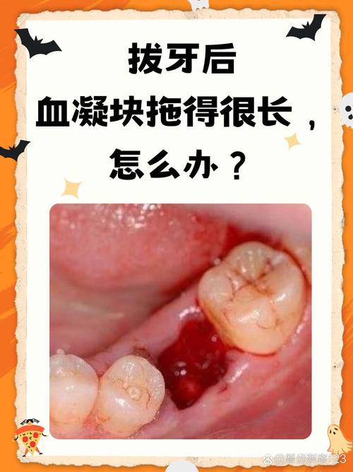 牙龈止血的方法-图1