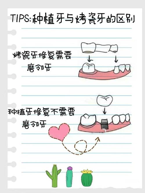 假牙和种牙的区别-图1