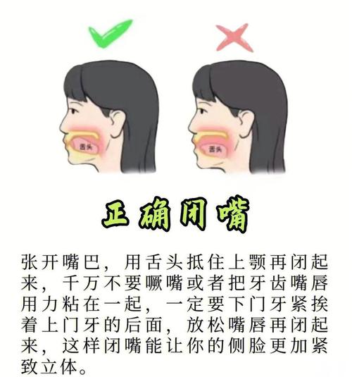 突嘴治疗方法有哪些？哪种更适合改善？-图1
