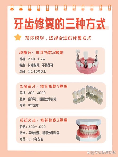 修牙有几种方法-图2