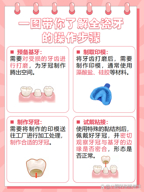 镶牙方法哪个好-图3