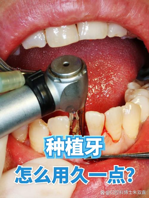 种的牙是什么样子-图2