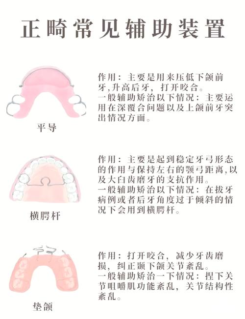 牙齿压低的方法-图3 牙齿压低的方法-图3