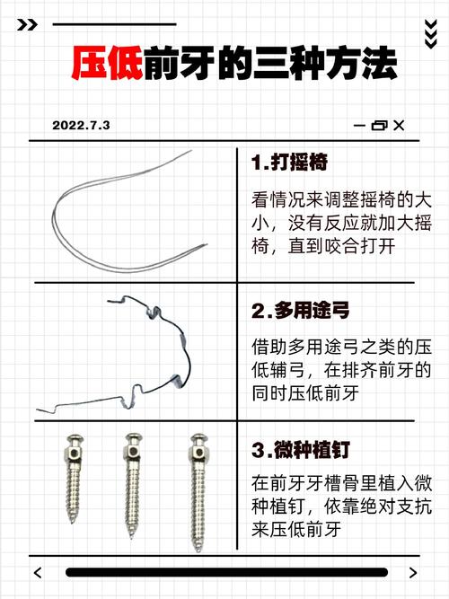 压低磨牙的方法-图1