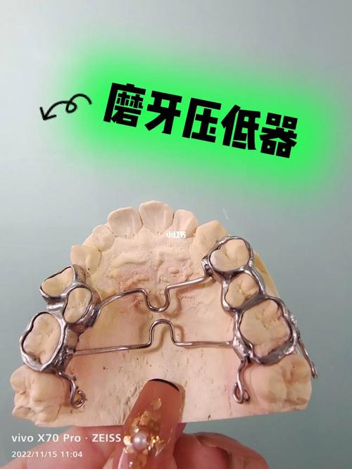 压低磨牙的方法-图2