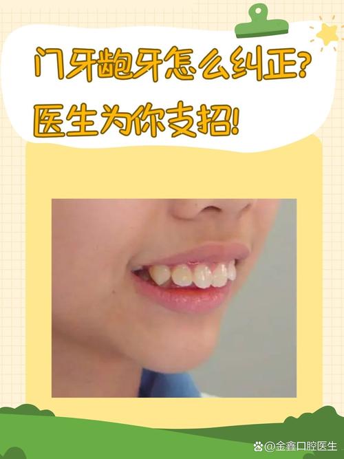 龅牙的治疗方法有哪些？哪种最有效且安全？-图3