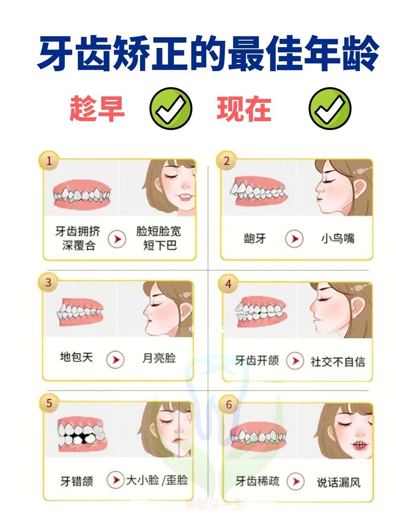 龅牙的治疗方法有哪些？哪种最有效且安全？-图2