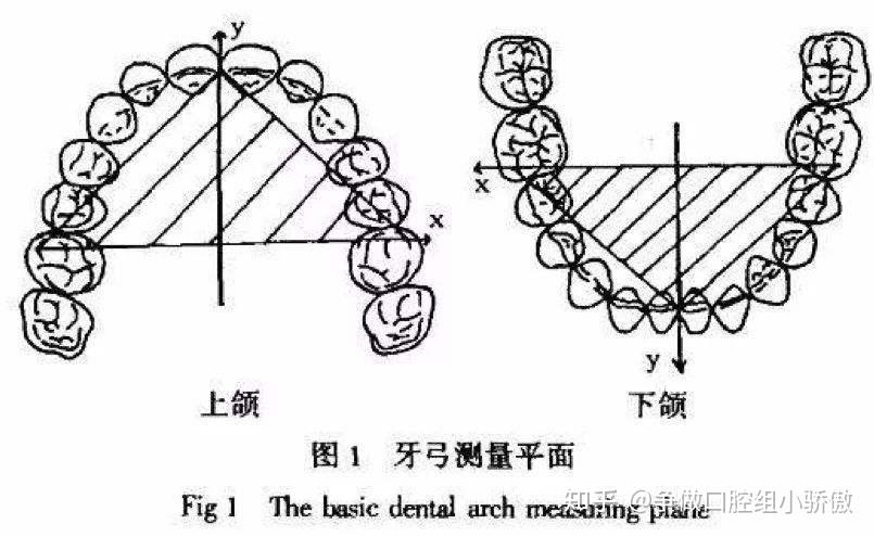 正畸模型如何分析牙量骨量协调性？-图3