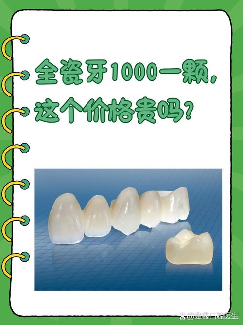 种一颗牙费用多少？全包价包含哪些项目？-图3