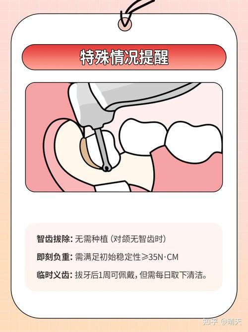 拔牙后多久可种牙-图2