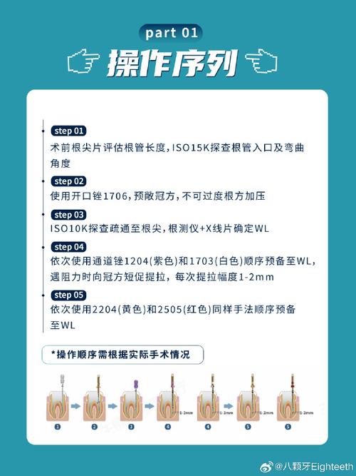 根管锉使用方法-图3