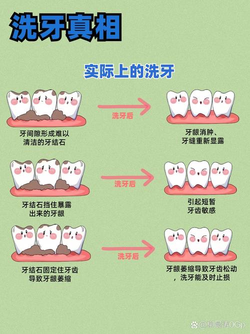 清洁牙齿的方法-图3 清洁牙齿的方法-图3