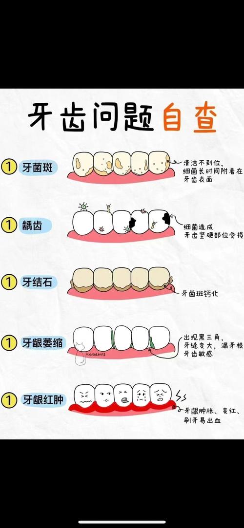 清洁牙齿的方法-图2 清洁牙齿的方法-图2