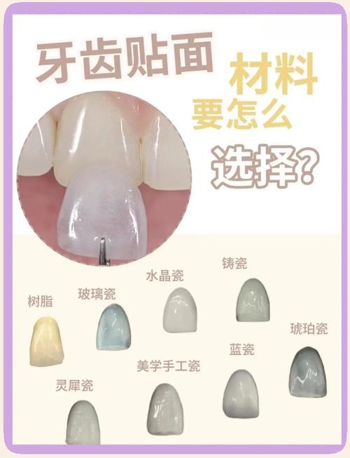 种牙选哪种材料好-图3