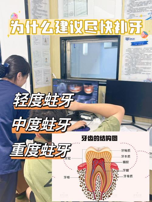 补牙最好方法是什么?如何选择最适合的?-图2 补牙最好方法是什么?如何选择最适合的?-图2