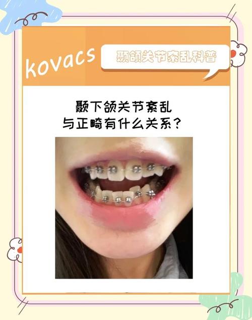 正畸后颞下颌关节紊乱-图3