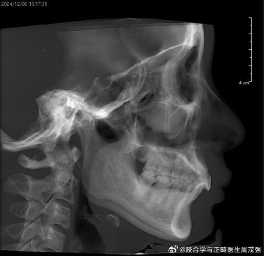 正畸后颞下颌关节紊乱-图2