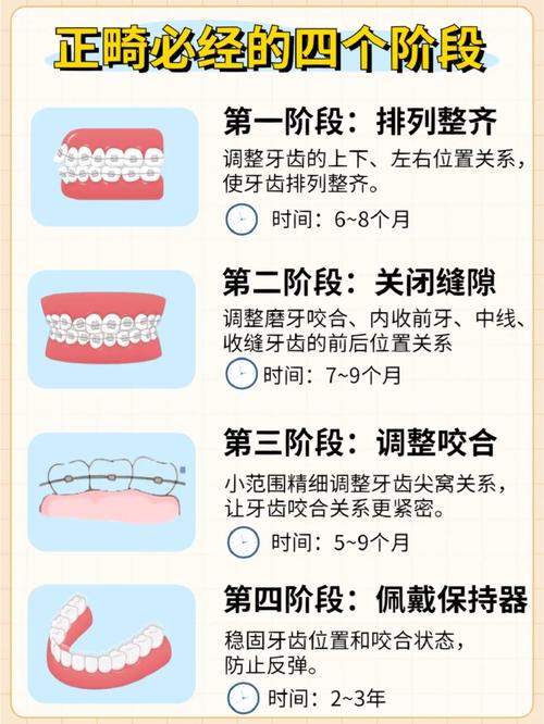 牙齿矫正方法这么多，哪种最适合你？-图3