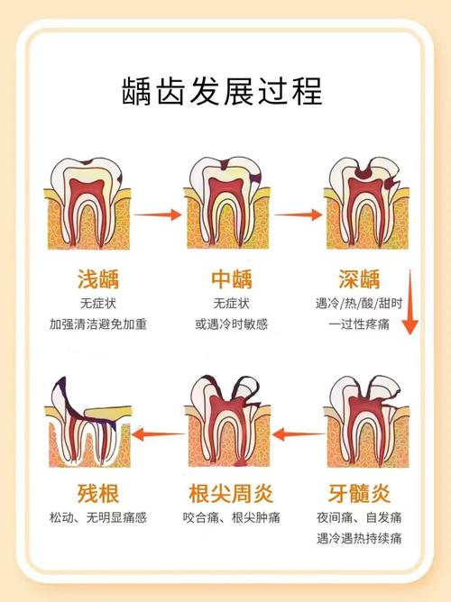 牙齿治疗方法有哪些？如何选择合适方案？-图3