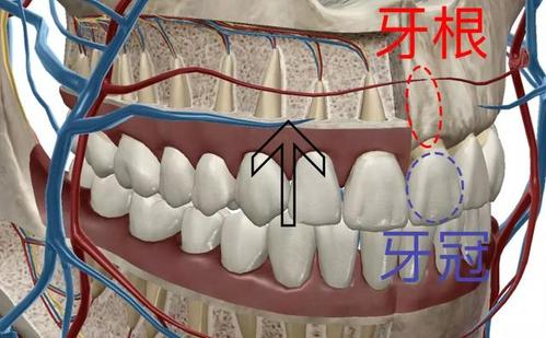 牙齿正畸会让牙根露出-图2