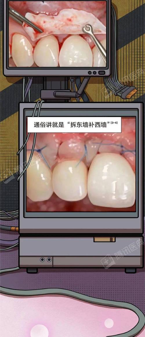 牙齿正畸会让牙根露出-图1