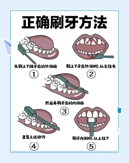 自己洗牙的方法-图1