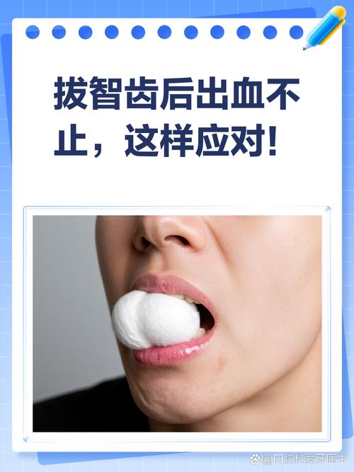 拔牙后止血方法-图1