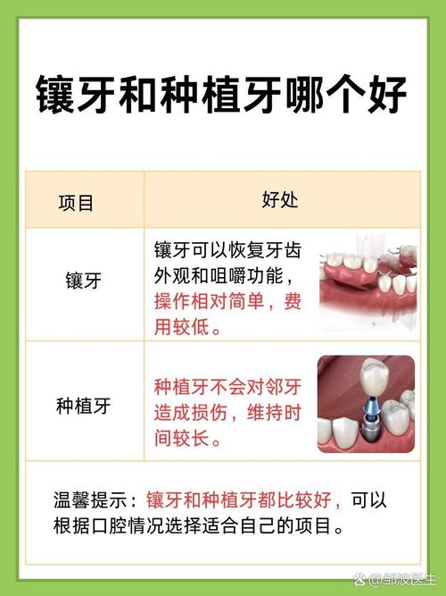 种牙好还是牙套好-图1 种牙好还是牙套好-图1