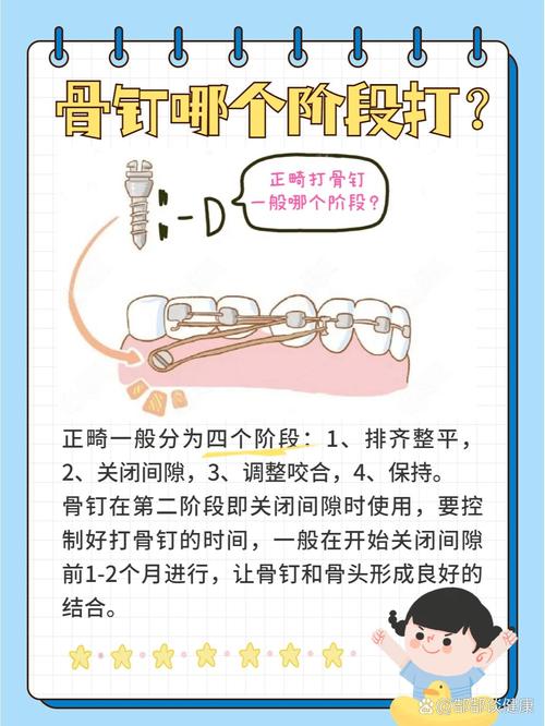 正畸在什么阶段打钉子-图3