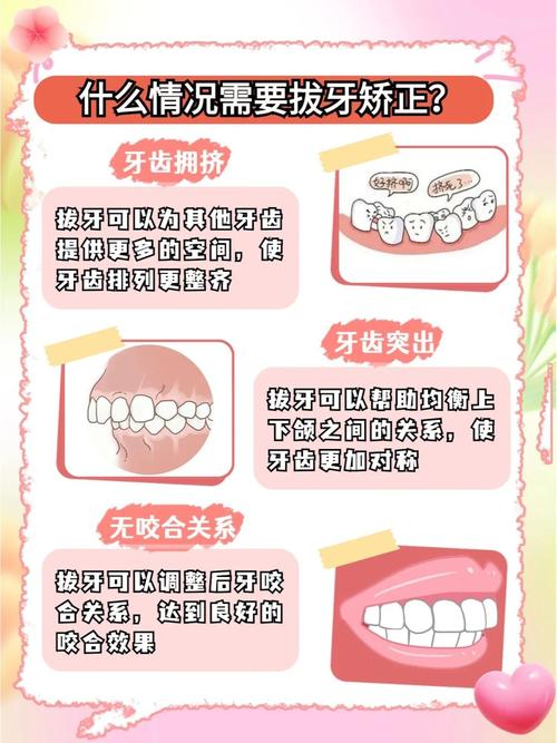 正畸拔牙应考虑的因素-图3