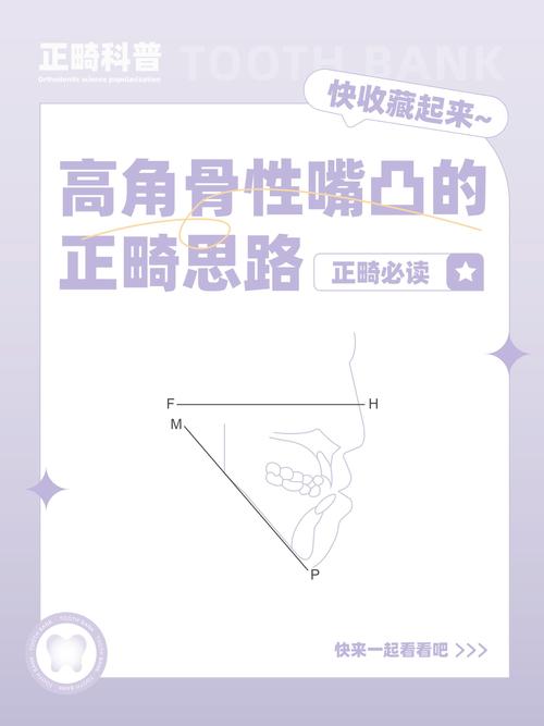 正畸如何确定骨性几类-图1