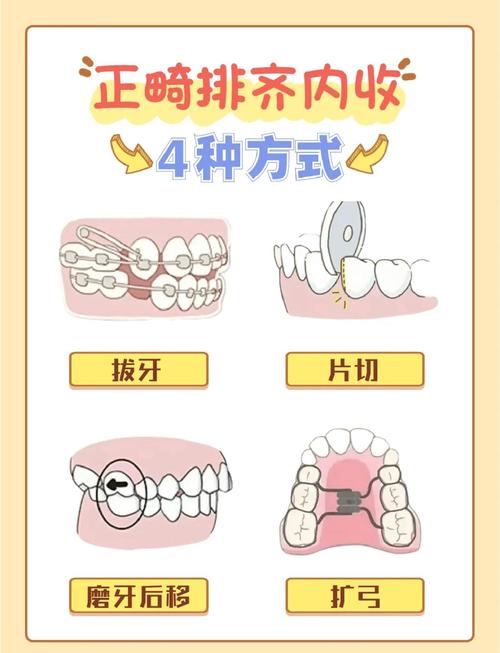 矫正牙齿有哪些方法?哪种更适合自己?-图3 矫正牙齿有哪些方法?哪种更适合自己?-图3