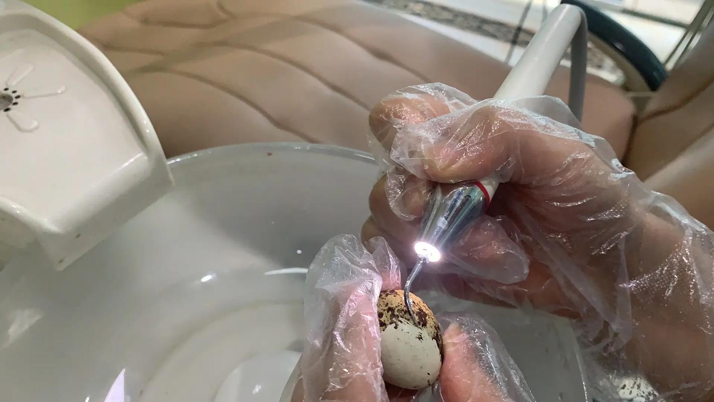 超声波洗牙方法-图1